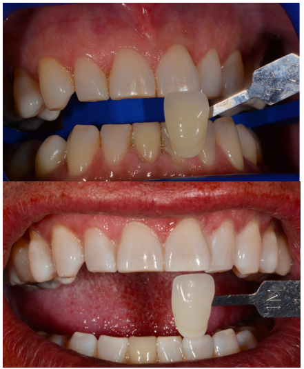 Conservative Cosmetic Dentistry