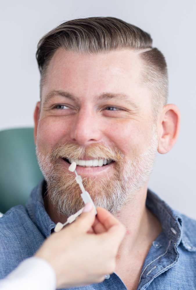 marina del rey family dentist patient model smiling