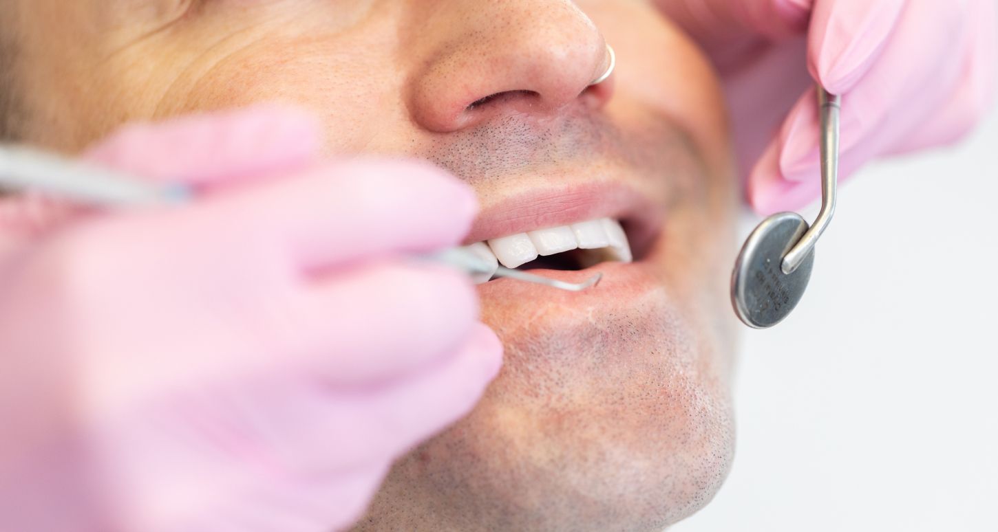 marina del rey dentist patient model with nose ring