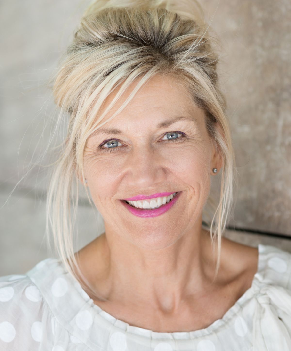 marina del rey longevity dentistry model with blonde hair