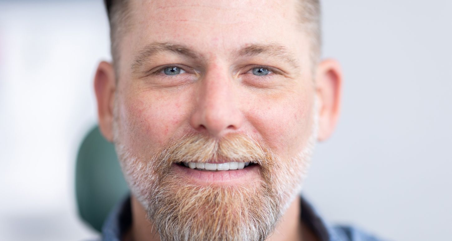 marina del rey dentist patient model with a beard