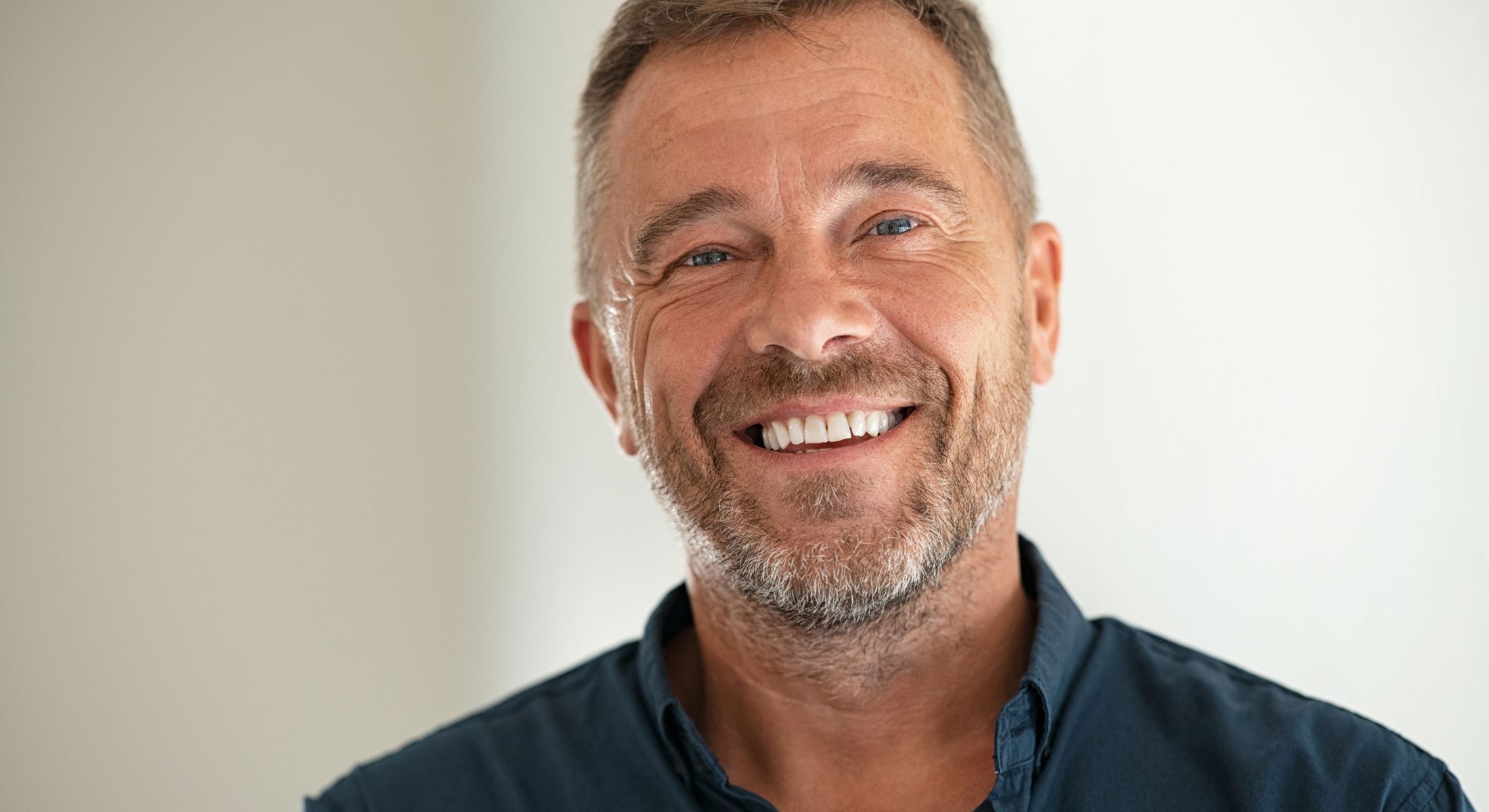 marina del rey implant-supported dentures model smiling