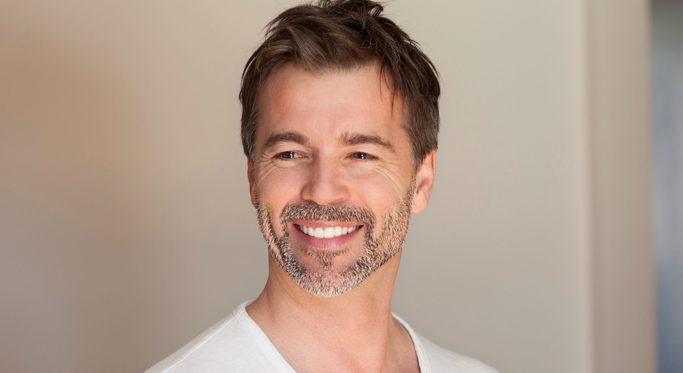 marina del rey all on four dental implants model with brown hair