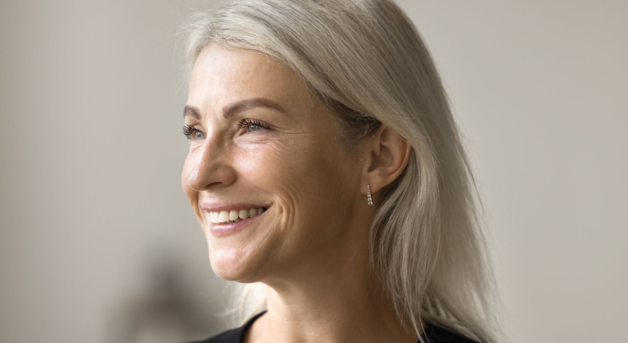 marina del rey anti aging dentistry model with blonde hair