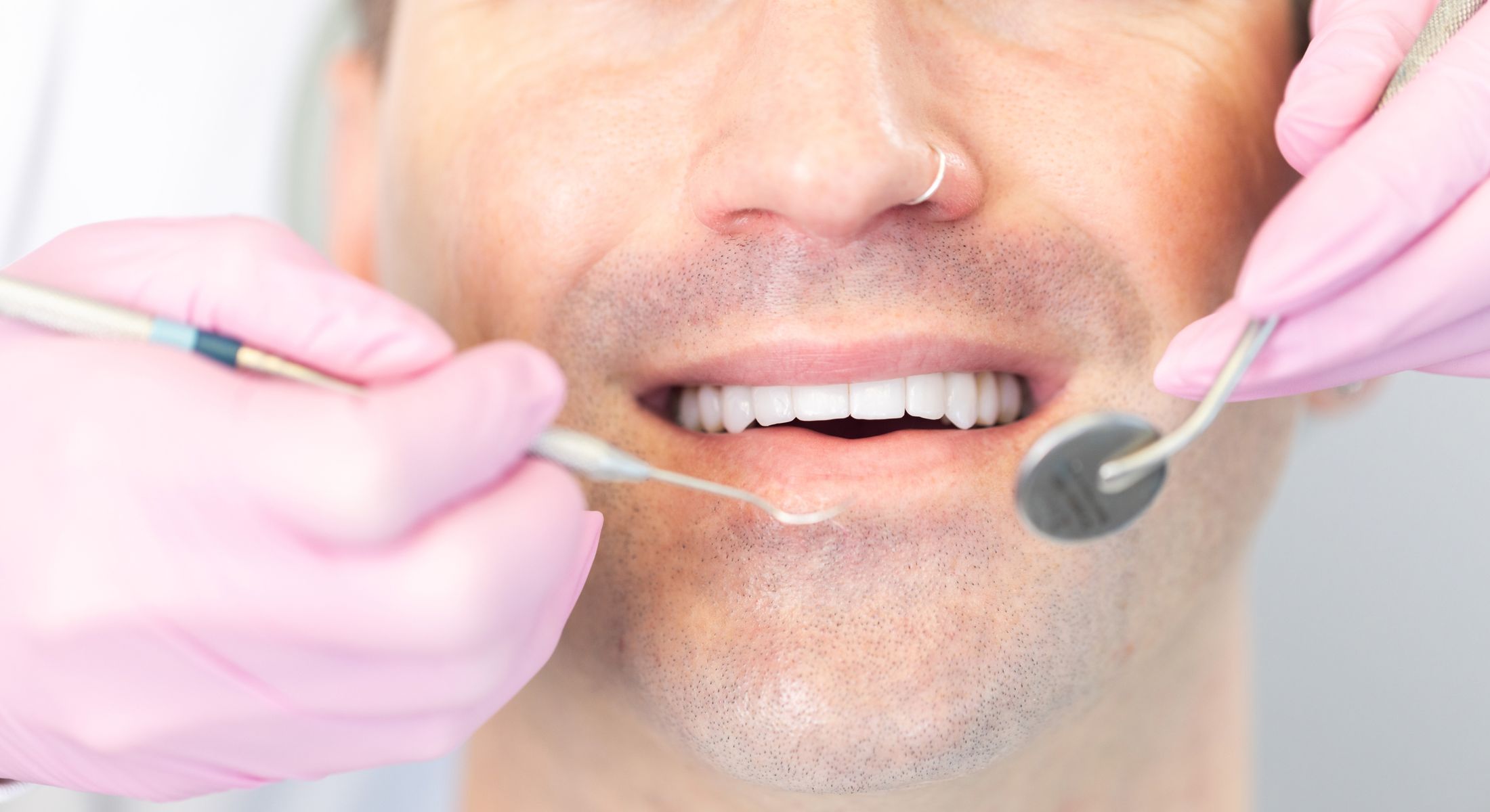 marina del rey root canal treatment model patient smiling